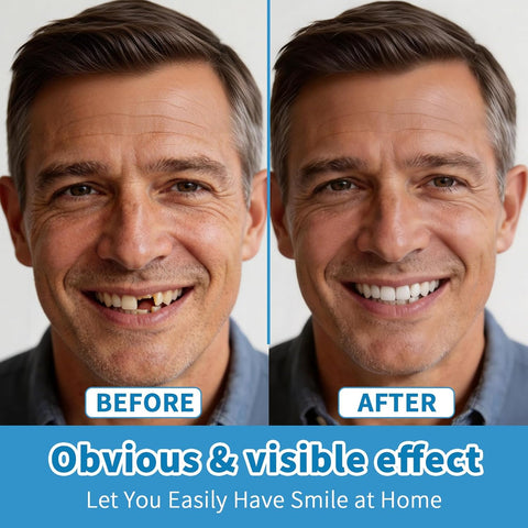 Silicone False Teeth Set – Men & Women